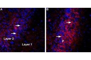 Immunohistochemistry (IHC) image for anti-Solute Carrier Family 17 (Sodium-Dependent Inorganic Phosphate Cotransporter), Member 8 (SLC17A8) (AA 533-545), (Cytosolic) antibody (ABIN7043680)