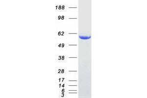 Western Blotting (WB) image for Syntrophin, alpha 1 (Dystrophin-Associated Protein A1, 59kDa, Acidic Component) (SNTA1) protein (Myc-DYKDDDDK Tag) (ABIN2733131)