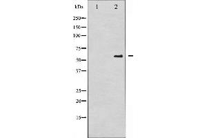 Western blot analysis of CDC25A phosphorylation expression in UV treated A2780 whole cell lysates,The lane on the left is treated with the antigen-specific peptide. (CDC25A 抗体  (pSer75))