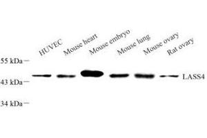 Western blot analysis of LASS4 (ABIN7073433) at dilution of 1: 1000 (LASS4 抗体)