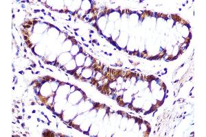 Immunohistochemistry of paraffin-embedded human colon using Cullin 4A Rabbit mAb (ABIN7266545) at dilution of 1:100 (40x lens). (Cullin 4A 抗体)