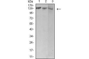 Western blot analysis using BCR mouse mAb against Jurkat (1), Hela (2), and Ramos (3) cell lysate. (BCR 抗体  (AA 139-280))
