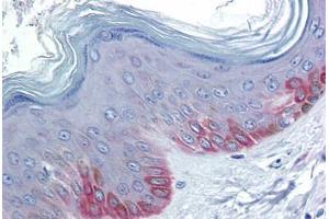 Human Skin: Formalin-Fixed, Paraffin-Embedded (FFPE) (FZD5 抗体  (AA 467-516))