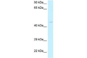 WB Suggested Anti-RPP40 Antibody Titration: 1.