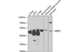 Western blot analysis of extracts of various cell lines, using  antibody (ABIN6131366, ABIN6136608, ABIN6136609 and ABIN6223268) at 1:1000 dilution. (AEBP2 抗体  (AA 234-503))
