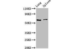 Western Blot Positive WB detected in: Rat lung tissue, Rat spleen tissue All lanes: RIPK2 antibody at 2. (RIPK2 抗体  (AA 1-540))