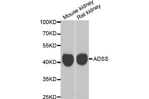 Western blot analysis of extracts of various cell lines, using GATM antibody. (GATM 抗体)