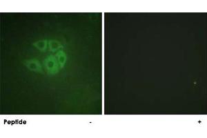 Immunofluorescence analysis of A-549 cells, using PLCB3 polyclonal antibody . (PLCB3 抗体)
