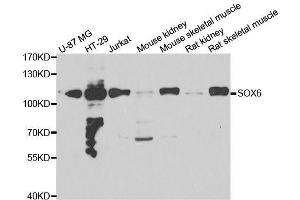 Western blot analysis of extracts of various cell lines, using SOX6 antibody. (SOX6 抗体  (AA 1-74))