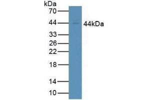 Detection of CD64 in Human Jurkat Cells using Polyclonal Antibody to Cluster Of Differentiation 64 (CD64)