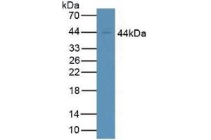 Detection of CD64 in Human Jurkat Cells using Polyclonal Antibody to Cluster Of Differentiation 64 (CD64) (FCGR1A 抗体  (AA 73-294))