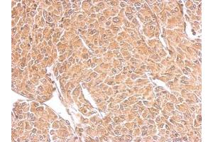 IHC-P Image TSPAN3 antibody detects TSPAN3 protein at cytosol on U87 xenograft by immunohistochemical analysis. (Tetraspanin 3 抗体)
