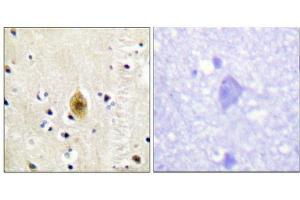 Immunohistochemistry analysis of paraffin-embedded human brain tissue, using Mst1/2 (Phospho-Thr183) antibody. (STK4 抗体  (pThr183))