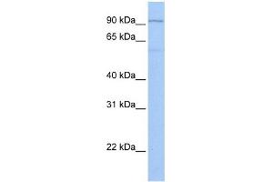 TTC16 antibody used at 1 ug/ml to detect target protein. (TTC16 抗体  (C-Term))