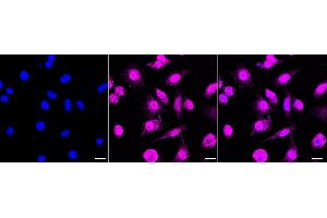 Immunocytochemical staining of HeLa cells with RAVER2 antibody (ABIN7800211), 1:1,000). (Recombinant RAVER2 抗体)