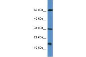 Image no. 1 for anti-Caspase Recruitment Domain Family, Member 17 (CARD17) (AA 51-100) antibody (ABIN6746959) (CARD17 抗体  (AA 51-100))