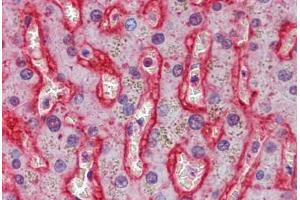 Immunohistochemistry (Formalin-fixed Paraffin-embedded Sections) (IHC (fp)) image for anti-Solute Carrier Family 2 (Facilitated Glucose Transporter), Member 2 (SLC2A2) (AA 277-290) antibody (ABIN574103)