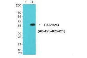 Western blot analysis of extracts from 293 cells (Lane 2), using PAK1/2/3 (Ab-423/402/421) antiobdy. (PAK1/2/3 抗体  (Thr402, Thr421, Thr423))