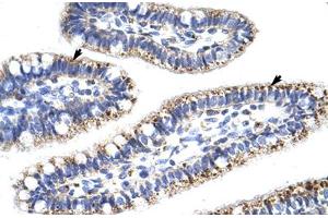 Immunohistochemical staining (Formalin-fixed paraffin-embedded sections) of human intestine with KLHL13 polyclonal antibody . (KLHL13 抗体  (AA 6-55))