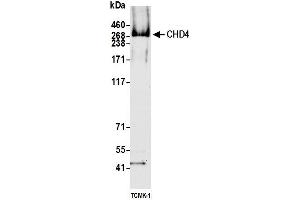 Western Blotting (WB) image for anti-Chromodomain Helicase DNA Binding Protein 4 (CHD4) (AA 50-100) antibody (ABIN7795622) (Recombinant CHD4 抗体  (AA 50-100))
