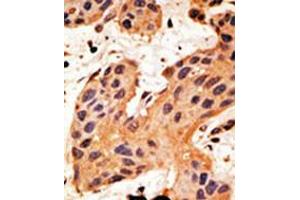 Immunohistochemistry (IHC) image for anti-Gap Junction Protein, alpha 8, 50kDa (GJA8) (AA 402-433), (C-Term) antibody (ABIN5536710)