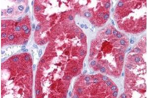Human Kidney: Formalin-Fixed, Paraffin-Embedded (FFPE) (REEP3 抗体  (C-Term))