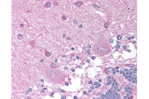 Anti-CHRNB2 antibody IHC of human brain, cerebellum.