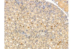 ABIN7094678 and ABIN7098729 at 1/100 staining Mouse kidney tissue by IHC-P.