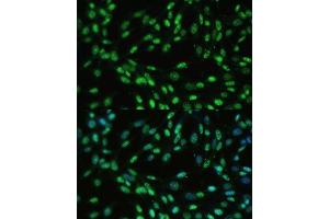 Immunofluorescence (IF) image for anti-DEAD (Asp-Glu-Ala-Asp) Box Polypeptide 39B (DDX39B) (AA 319-428) antibody (ABIN6139492)