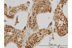 Immunostaining (ISt) image for anti-E3 ubiquitin-protein ligase RAD18 (RAD18) (AA 332-430) antibody (ABIN566046)
