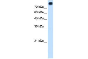 CDH3 antibody used at 1. (P-Cadherin 抗体)
