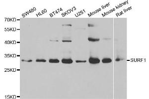 Western blot analysis of extracts of various cell lines, using SURF1 antibody. (SURF1 抗体)