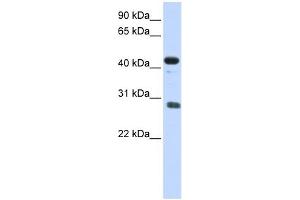 CDCA5 antibody used at 1 ug/ml to detect target protein. (CDCA5 抗体  (Middle Region))