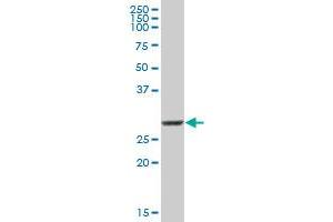 COMT MaxPab polyclonal antibody. (COMT 抗体  (AA 1-221))
