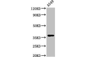 Western Blot Positive WB detected in: A549 whole cell lysate All lanes: ZNF488 antibody at 3. (ZNF488 抗体  (AA 1-200))
