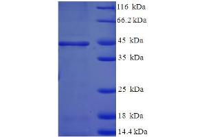 SDS-PAGE (SDS) image for 17-beta-Hydroxysteroid Dehydrogenase 14 (DHB14) (AA 1-270), (full length) protein (His-SUMO Tag) (ABIN5711729)