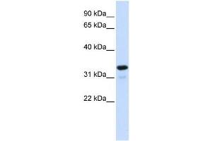 NFKBIA antibody (70R-10522) used at 0. (NFKBIA 抗体  (Middle Region))