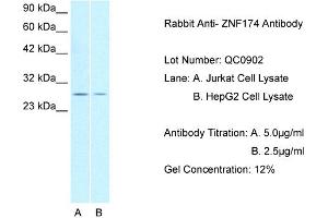 Host: Rabbit Target Name: ZNF174 Sample Type: Lane: A. (ZNF174 抗体  (N-Term))