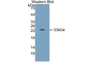 Western Blotting (WB) image for anti-Hexosaminidase B (Beta Polypeptide) (HEXB) (AA 122-311) antibody (ABIN3208194) (HEXB 抗体  (AA 122-311))