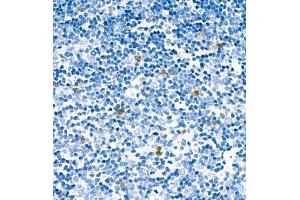 Immunohistochemistry analysis of paraffin embedded mouse thymus using CA13 (ABIN7073310) at dilution of 1: 400 (CA13 抗体)