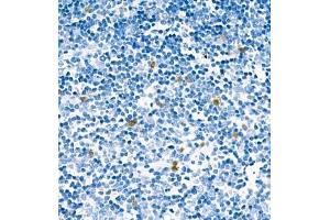 Immunohistochemistry analysis of paraffin embedded mouse thymus using CA13 (ABIN7073310) at dilution of 1: 400