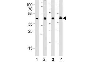 Western Blotting (WB) image for anti-Isocitrate Dehydrogenase 1 (NADP+), Soluble (IDH1) (AA 116-143) antibody (ABIN3031506)