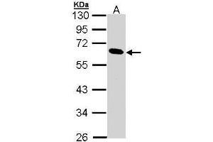 Western Blotting (WB) image for anti-Pancreatic Lipase (PNLIP) antibody (ABIN2856717)