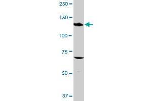 ITGAV MaxPab rabbit polyclonal antibody. (CD51 抗体  (AA 1-1048))