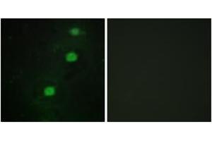 Immunofluorescence (IF) image for anti-Cyclin-Dependent Kinase 20 (CDK20) (AA 31-80) antibody (ABIN2889669) (CCRK 抗体  (AA 31-80))