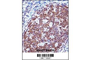 ZAP70 Antibody immunohistochemistry analysis in formalin fixed and paraffin embedded human tonsil tissue followed by peroxidase conjugation of the secondary antibody and DAB staining. (ZAP70 抗体  (AA 276-304))