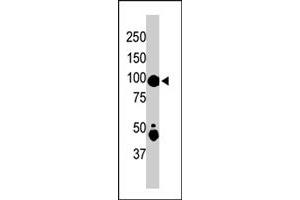 The MAP4K2 polyclonal antibody  is used in Western blot to detect MAP4K2 in mouse skeletal muscle tissue lysate . (MAP4K2 抗体  (Internal Region))