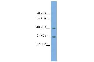 WB Suggested Anti-HSD3B7 Antibody Titration:  0. (HSD3B7 抗体  (Middle Region))