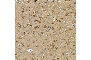 Immunohistochemistry of paraffin-embedded mouse brain using PRPS Rabbit pAb (ABIN7269365) at dilution of 1:100 (40x lens). (PRPSAP2 抗体  (AA 1-90))