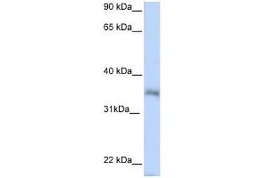 HEXIM2 antibody used at 1 ug/ml to detect target protein.